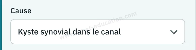 Panneau du modèle : choix de la cause, ténosynovite, kyste synovial ou lipome dans le canal.