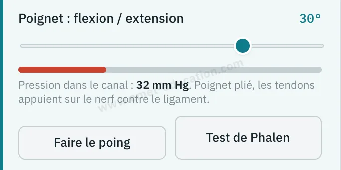 Panneau du modèle : flexion du poignet, jauge de pression dans le canal, boutons « Faire le poing » et « Test de Phalen ».